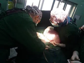 کیست 10 کیلویی از شکم خانم 37 ساله خارج شد